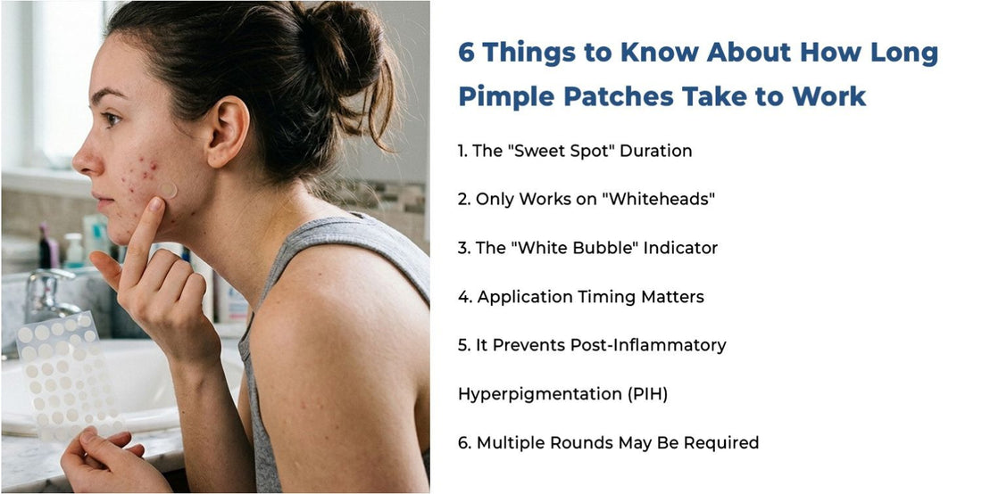 6 Things to Know About How Long Pimple Patches Take to Work